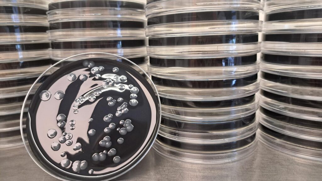 Qu’est-ce que la Legionella ? 